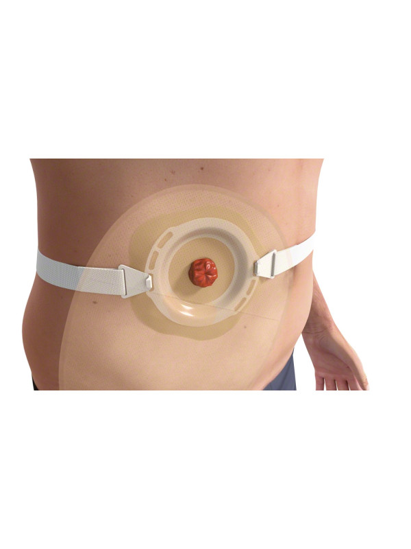 5028T PASEK STOMA CARE Pasek podtrzymujący sprzęt stomijny B. BRAUN