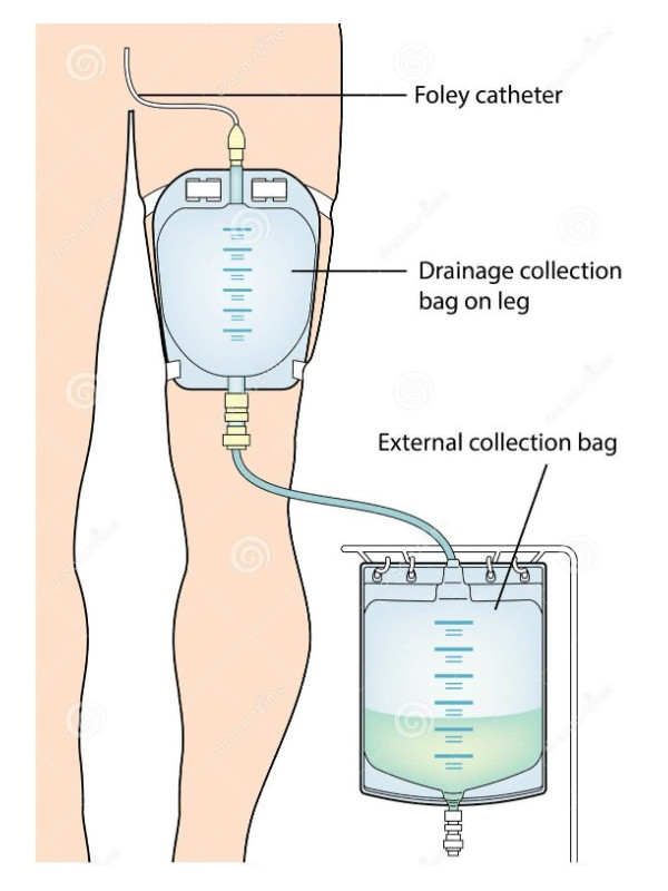 11061901 Worek Do zbiórki Moczu 0,35 L Dren 30 cm Leg Bag Premium Przezroczysty MBH QUFORA