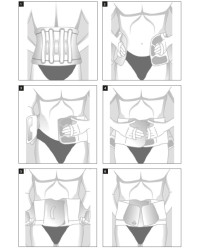 Pas Na Ból Kręgosłupa Odcinek Lędźwiowo Krzyżowy Orliman EV-101