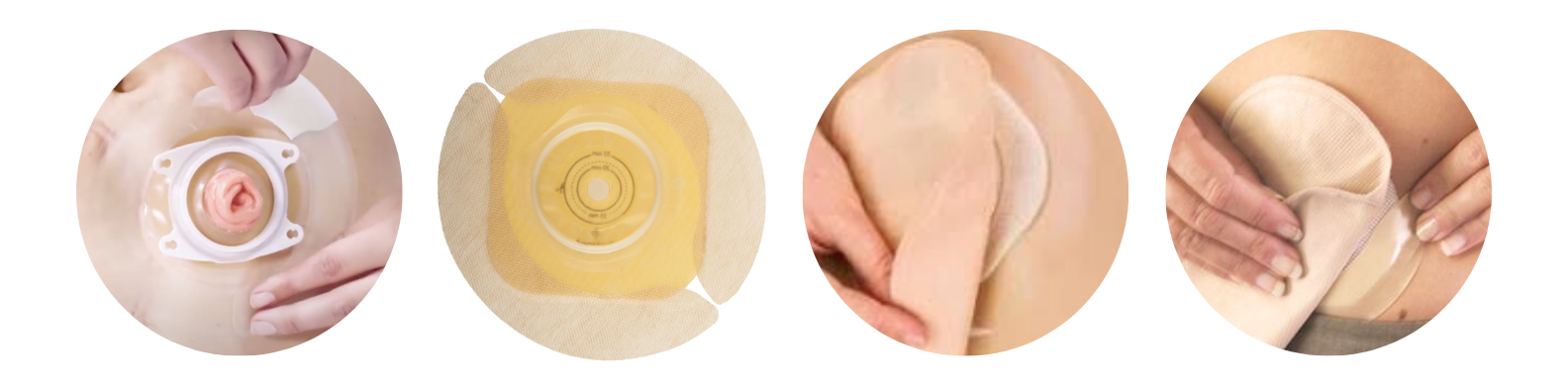  Instrukcja przyklejania pasków hydrokoloidowych zabezpieczających płytkę worka stomijnego – różne sposoby umieszczania pasków wokół przylepca dla lepszej szczelności i stabilizacji.