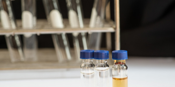 Cewnikowanie moczowodu i postępowanie po wyjęciu cewnika. O czym warto pamiętać?