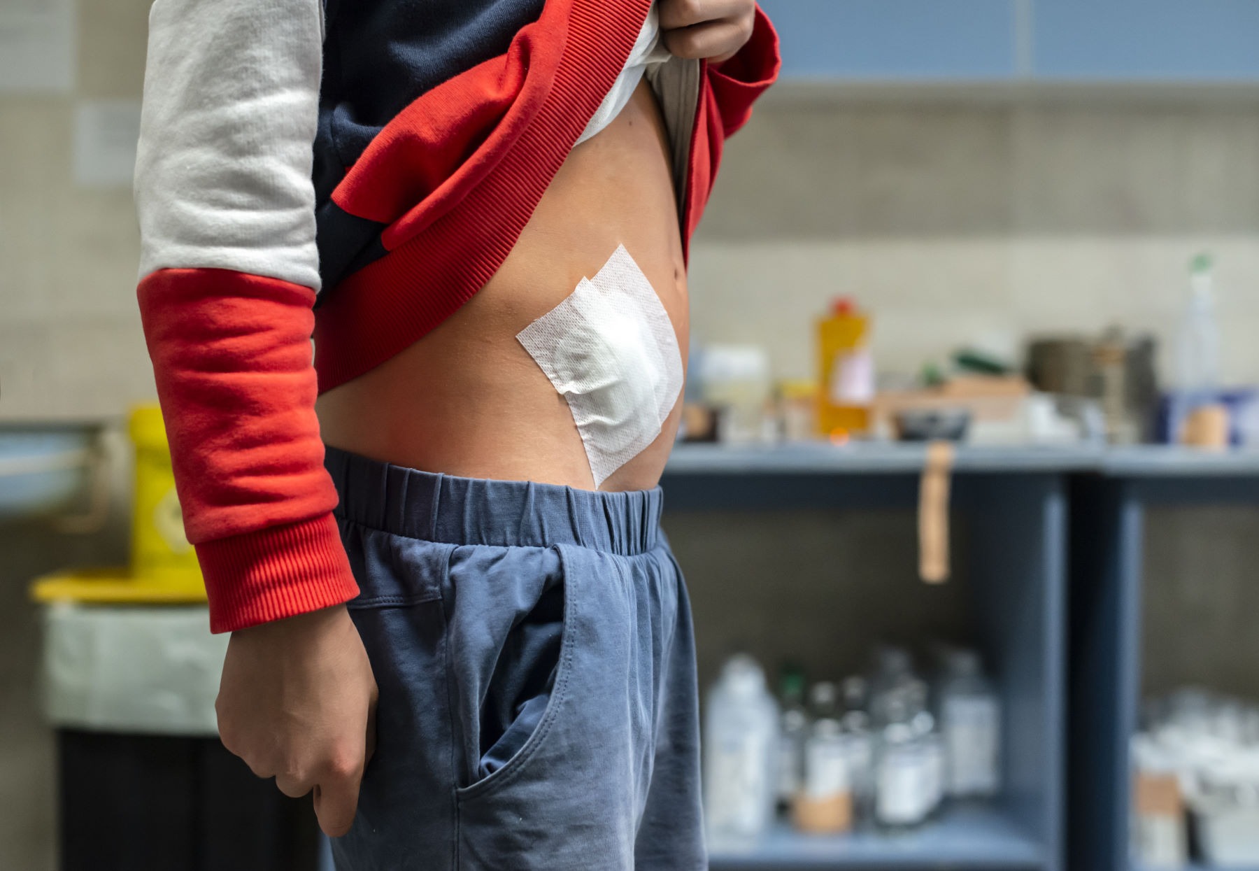 Stomia - kiedy zbieg, powikłania i właściwa higiena i pielęgnacja