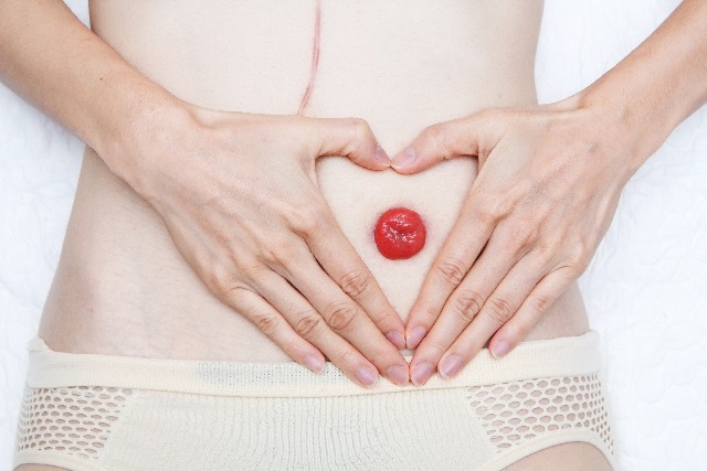 Życie stomika. Jakie są rodzaje stomii?