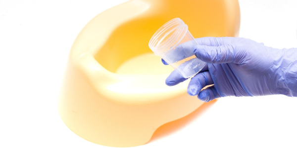 Podwyższona amylaza w moczu – przyczyny, badanie, leczenie