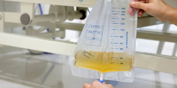 Jak opróżnić worek do moczu ?