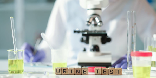 Piana w moczu – co oznacza spieniony mocz?   