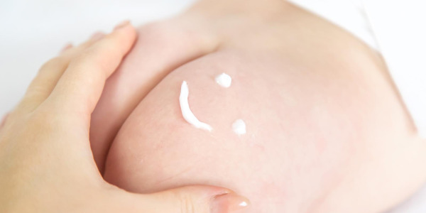 Pieluszkowe zapalenie skóry – objawy, leczenie i profilaktyka