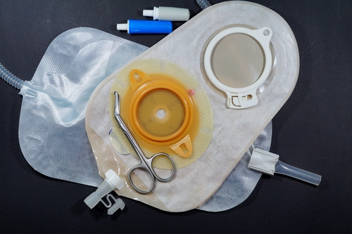 Urostomia - podstawowe informacje