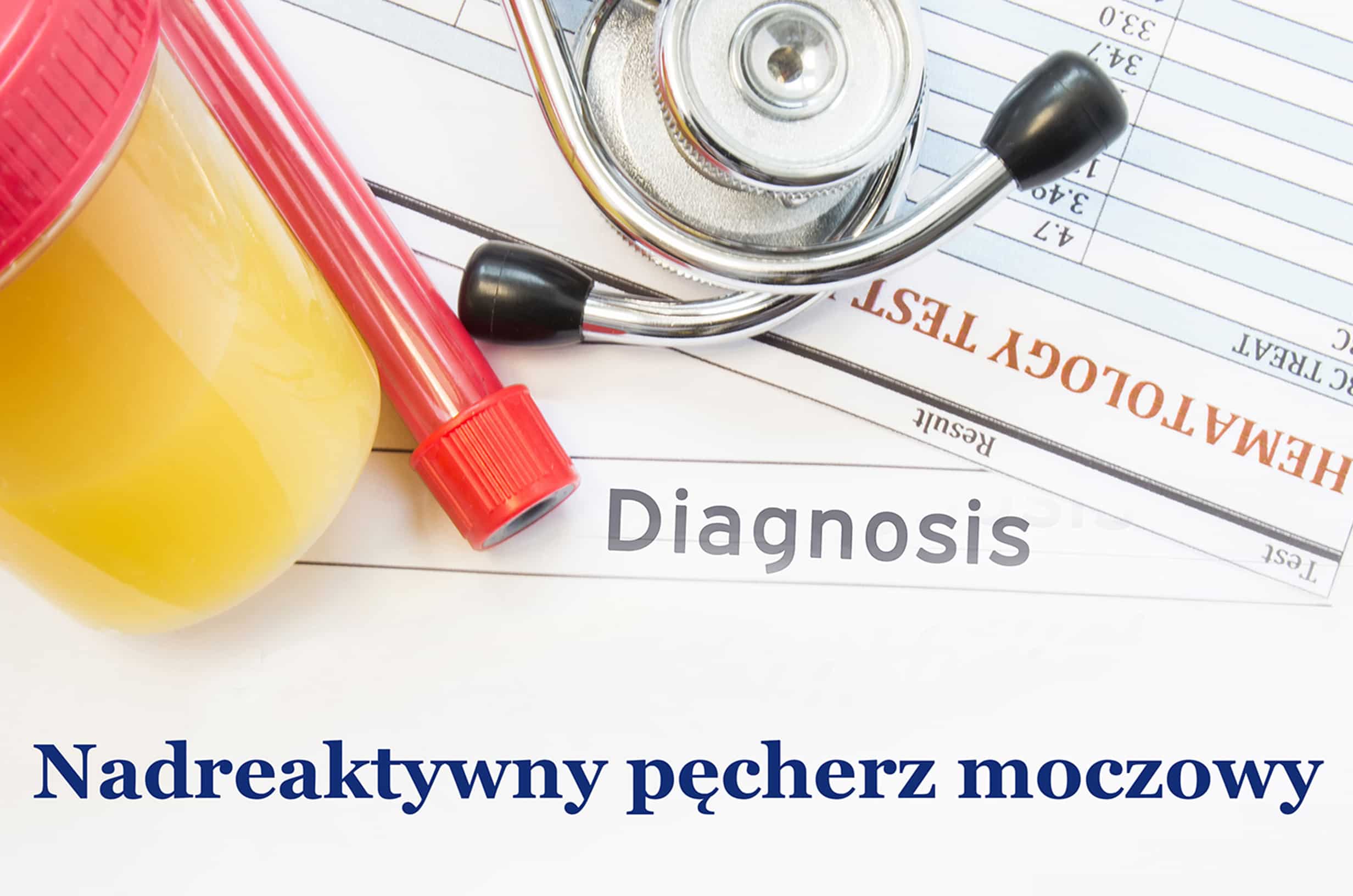 Nadreaktywny pęcherz moczowy - co warto o nim wiedzieć?